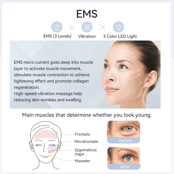 ANLAN EMS Facial Massager Pro Face Lifting Skin Rejuvenation Cold Compress Deep Cleaning Anti-aging Skincare Beauty Device