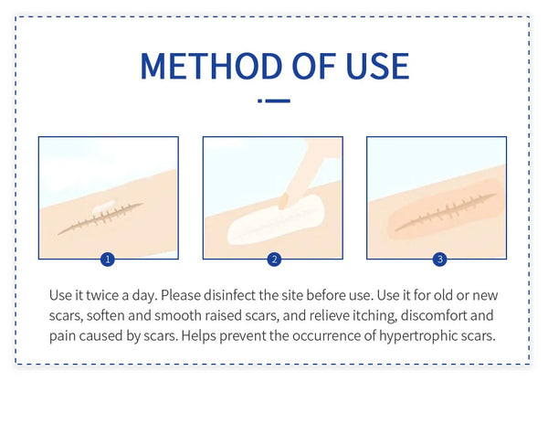 Scar Removal Cream – Acne, Stretch Marks & Whitening