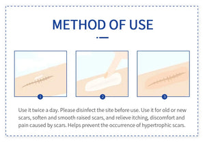 Scar Removal Cream Gel Remove Acne Spots Treatment Stretch Marks Burn Surgical Scar Repair Cream Smoothing Whitening Skin Beauty