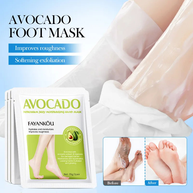 Avocado Foot Exfoliating Mask – Moisturizing Dead Skin Remover (1/3/5 Pairs)