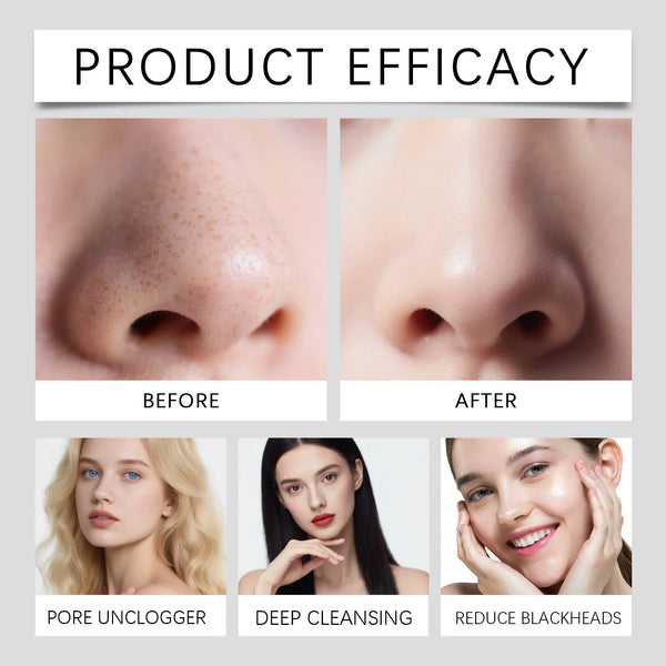 Peel Mud Mask – Deep Cleansing & Brightening