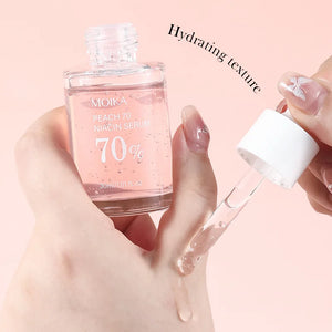 Niacinamide Serum – Dark Spot & Pore Minimizer