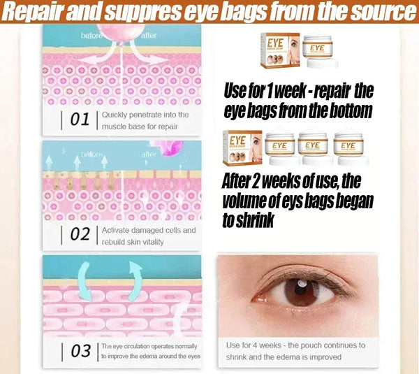 Remove Eye Bag Cream Anti Wrinkle Anti Dark Circle Eye Cream Repair Skin Damage Moisturizing Eye Bags Eyes Skin Care