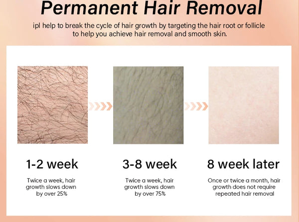 KODO 2026 High-end customization ice Laser Hair removal Laser Epilator Permanent IPL Painless Photoepilator 4 in 1 face and body