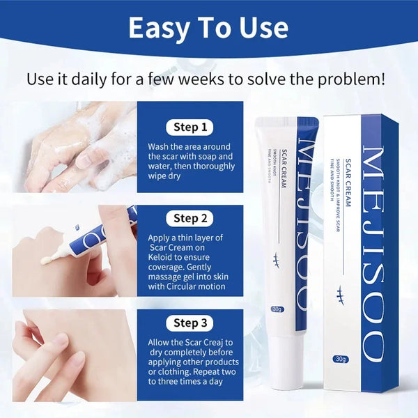Scar Removal Cream – Acne, Stretch Marks & Whitening