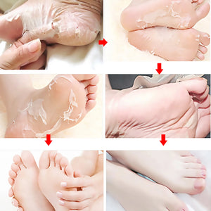 Fruit Acid Foot Exfoliating Mask – 5 Pairs Moisturizing Dead Skin Remover