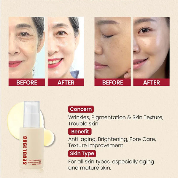 Korean SEOUL 1988 Retinol Serum – Anti-Wrinkle & Whitening