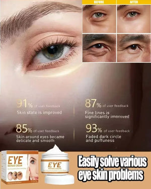 Remove Eye Bag Cream Anti Wrinkle Anti Dark Circle Eye Cream Repair Skin Damage Moisturizing Eye Bags Eyes Skin Care