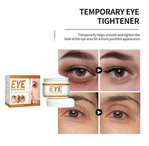 Remove Eye Bag Cream Anti Wrinkle Anti Dark Circle Eye Cream Repair Skin Damage Moisturizing Eye Bags Eyes Skin Care