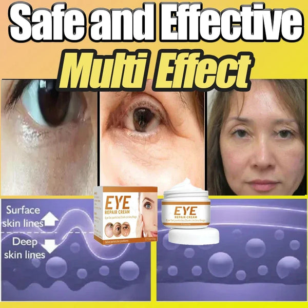 Anti-Eye Bag & Dark Circle Cream – Moisturizing & Repairing