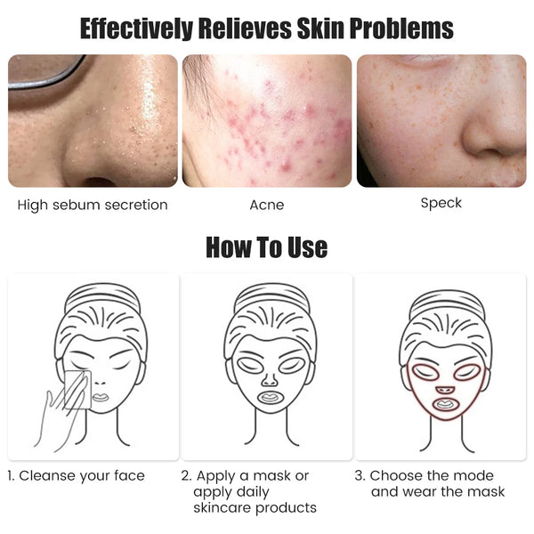 Rechargeable 7-Color LED Facial Mask – Skin Rejuvenation & Lifting