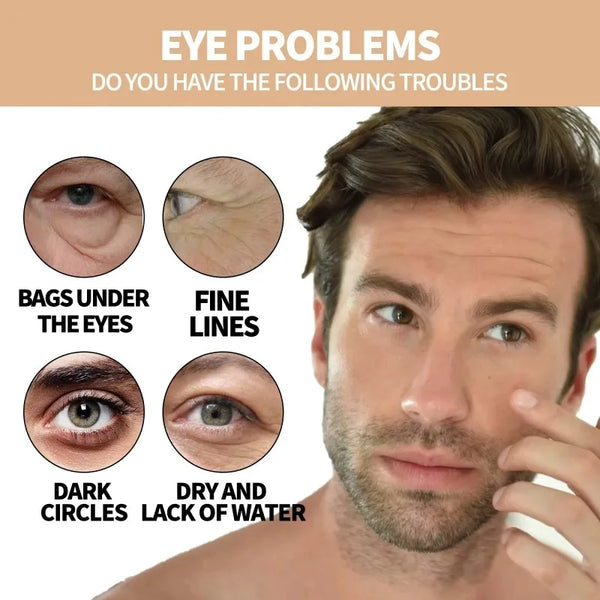 Remove Eye Bag Cream Anti Wrinkle Anti Dark Circle Eye Cream Repair Skin Damage Moisturizing Eye Bags Eyes Skin Care