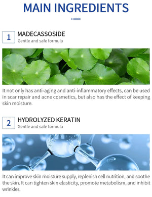 Scar Removal Cream Gel Remove Acne Spots Treatment Stretch Marks Burn Surgical Scar Repair Cream Smoothing Whitening Skin Beauty