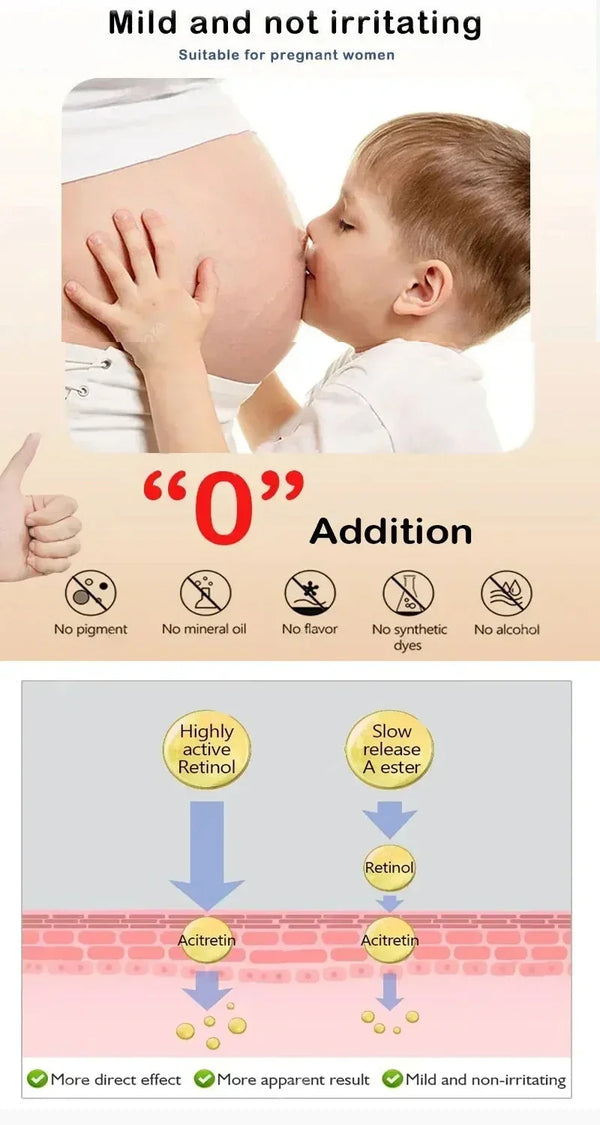 Anti-Eye Bag & Dark Circle Cream – Moisturizing & Repairing