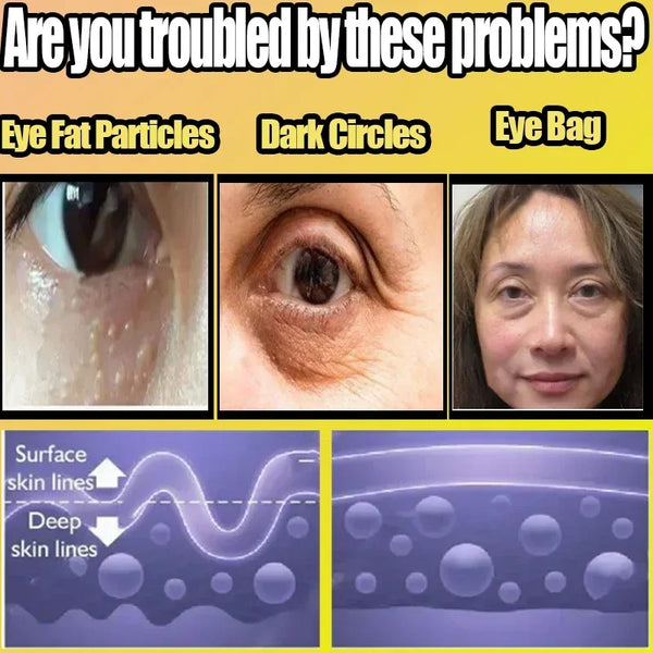 Remove Eye Bag Cream Anti Wrinkle Anti Dark Circle Eye Cream Repair Skin Damage Moisturizing Eye Bags Eyes Skin Care