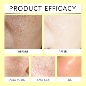 Turmeric Kojic Acid Cleansing Pads