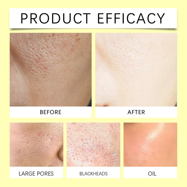 Turmeric Kojic Acid Cleansing Pads