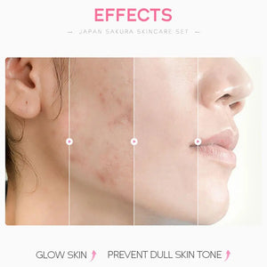 Sakura Skincare Set – Face Cream, Serum, Toner & More