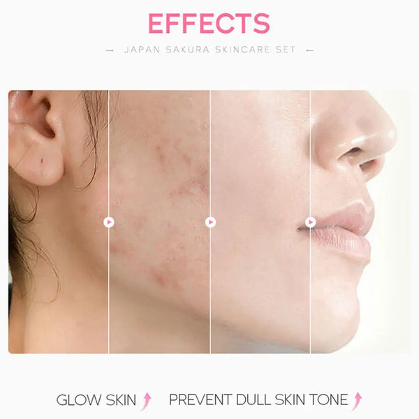 Sakura Skincare Set – Face Cream, Serum, Toner & More