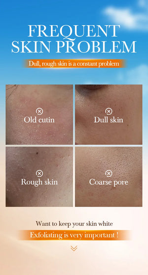 Orange Exfoliating Peeling Gel – Face Scrub & Blackhead Remover