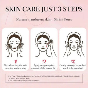 Niacinamide Serum – Dark Spot & Pore Minimizer