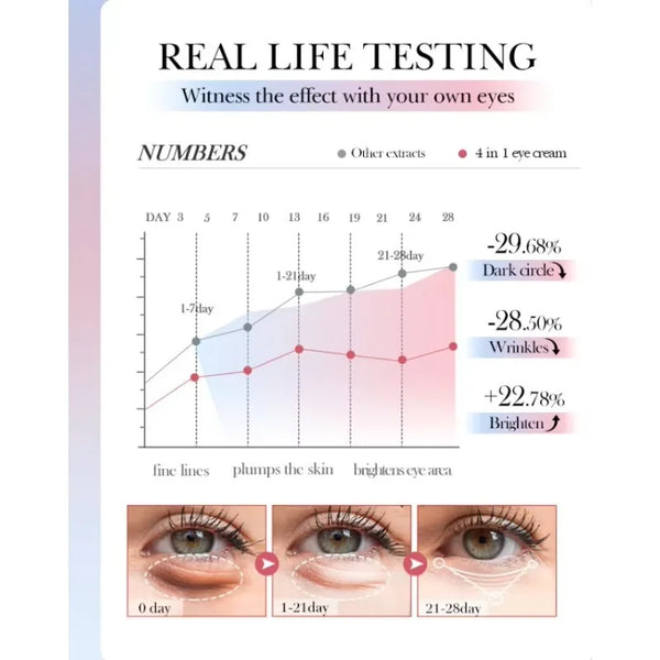 Remove Eye Bag Cream Anti Wrinkle Anti Dark Circle Eye Cream Repair Skin Damage Moisturizing Eye Bags Eyes Skin Care