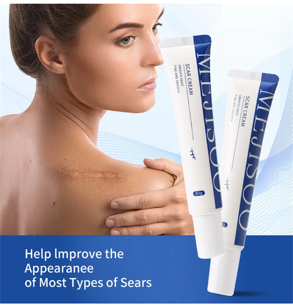 Scar Removal Cream Gel Remove Acne Spots Treatment Stretch Marks Burn Surgical Scar Repair Cream Smoothing Whitening Skin Beauty
