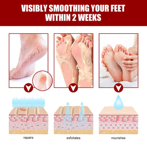 Fruit Acid Foot Exfoliating Mask – 5 Pairs Moisturizing Dead Skin Remover