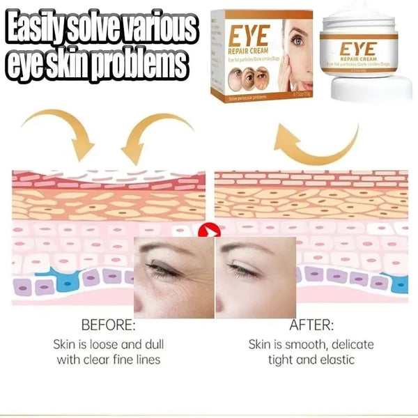 Remove Eye Bag Cream Anti Wrinkle Anti Dark Circle Eye Cream Repair Skin Damage Moisturizing Eye Bags Eyes Skin Care