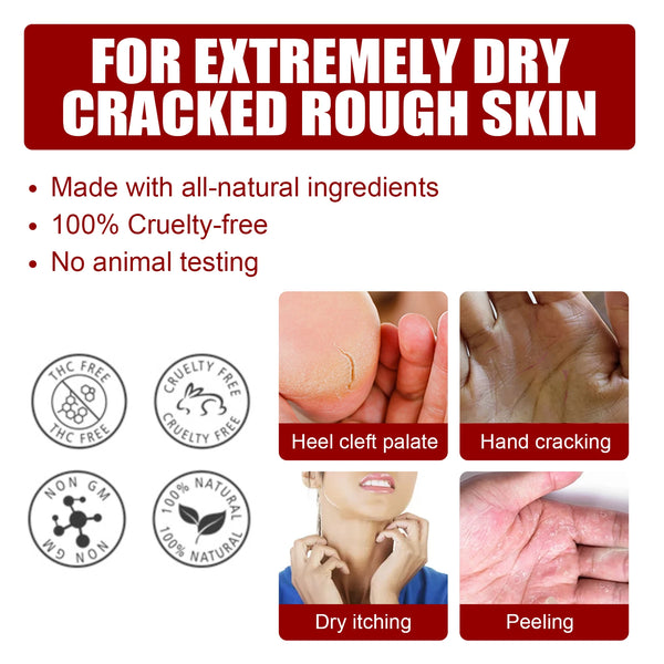 Fruit Acid Foot Exfoliating Mask – 5 Pairs Moisturizing Dead Skin Remover