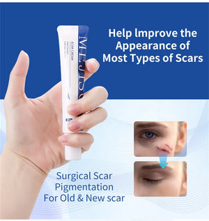 Scar Removal Cream Gel Remove Acne Spots Treatment Stretch Marks Burn Surgical Scar Repair Cream Smoothing Whitening Skin Beauty