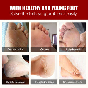 Fruit Acid Foot Exfoliating Mask – 5 Pairs Moisturizing Dead Skin Remover