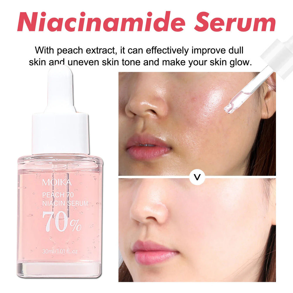 Niacinamide Serum – Dark Spot & Pore Minimizer