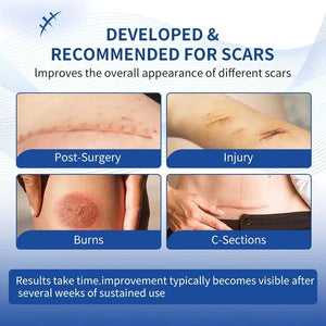 Scar Removal Cream – Acne, Stretch Marks & Whitening