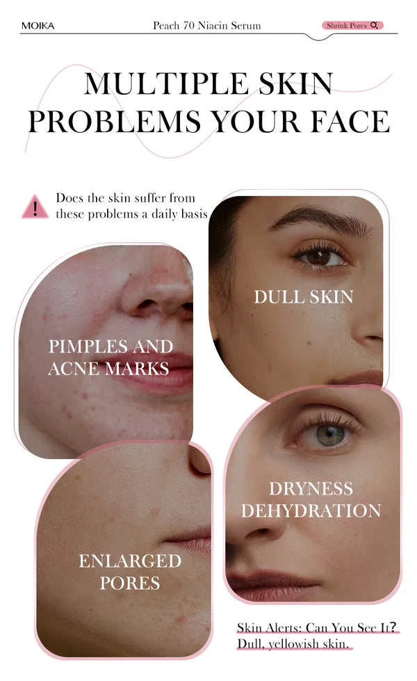 Niacinamide Serum – Dark Spot & Pore Minimizer