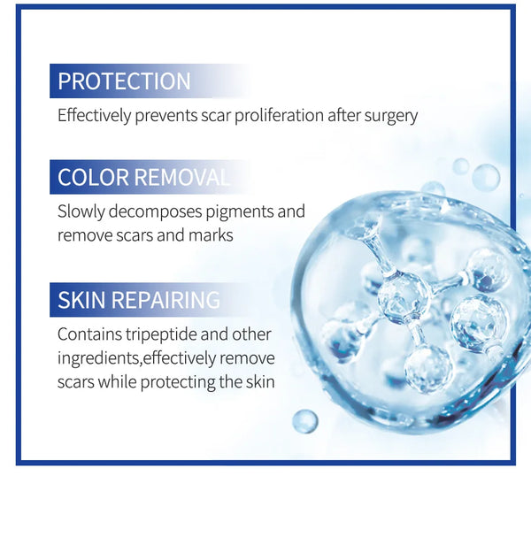 Scar Removal Cream Gel Remove Acne Spots Treatment Stretch Marks Burn Surgical Scar Repair Cream Smoothing Whitening Skin Beauty