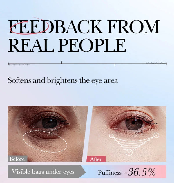 Anti-Eye Bag & Dark Circle Cream – Moisturizing & Repairing